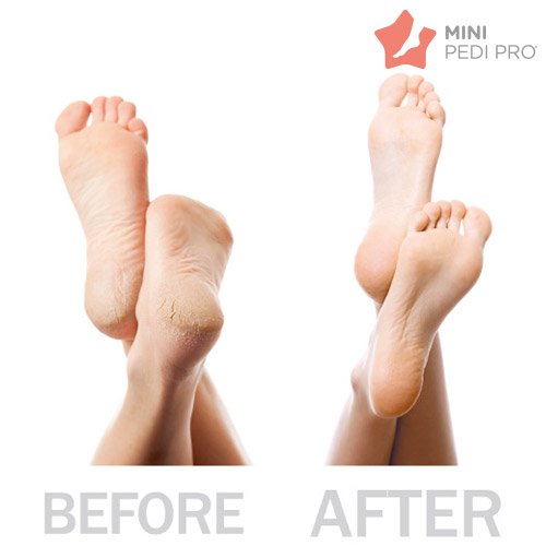 MINI-Pedi-Pro-Pedikyyrisetti-1 MINI-Pedi-Pro-Pedikyyrisetti-1